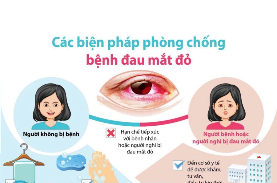 Bệnh đau mắt đỏ: Nguyên nhân - Triệu chứng - Cách điều trị và Biện pháp phòng tránh